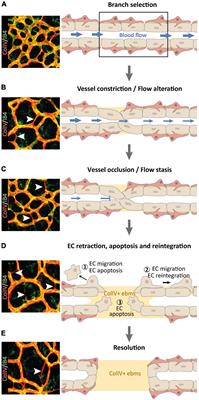 Lymphatic Vessel Regression and Its Therapeutic Applications: Learning From Principles of Blood Vessel Regression